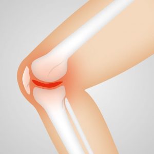 Knee Replacemen in Lahore Pakistan