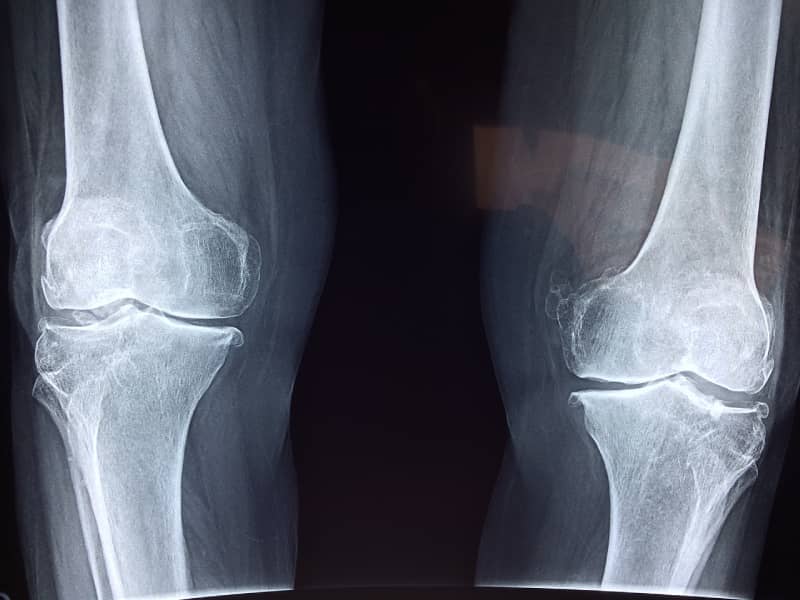 knee pain orthopedic doctor in Lahore