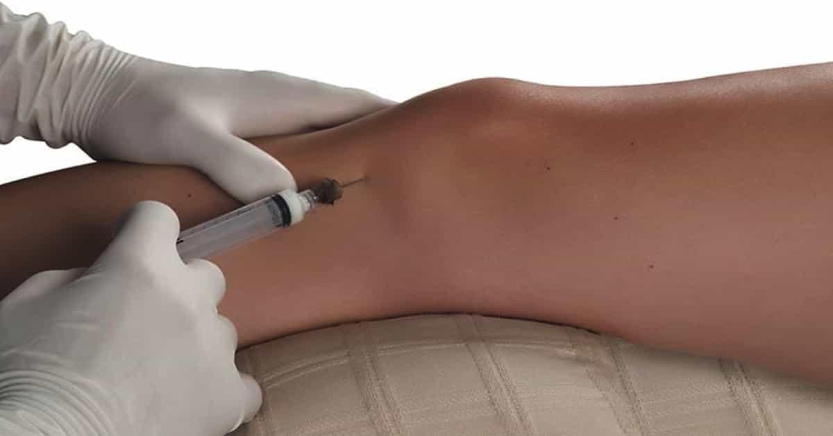You are currently viewing Role of P Injection in Orthopedic | Dr Bilal Orthopedic Surgeon